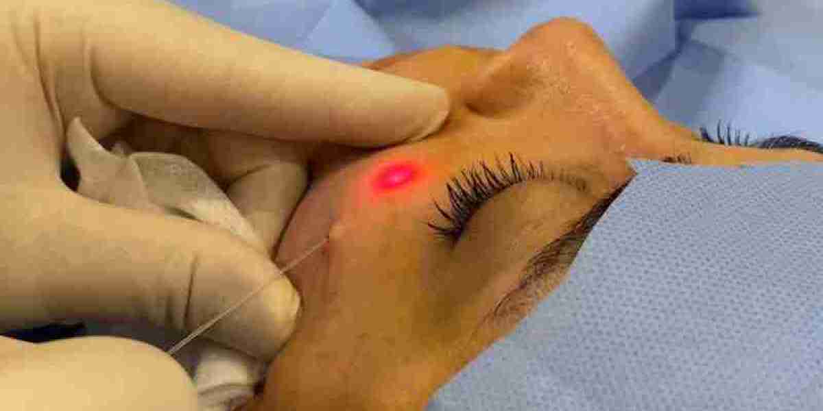 Endolift Laser Dubai: Lift, Tighten, and Refresh Without Surgery