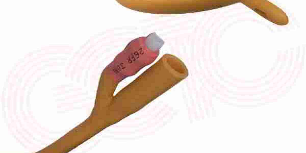 Foley Balloon Catheter: A Trusted Medical Device